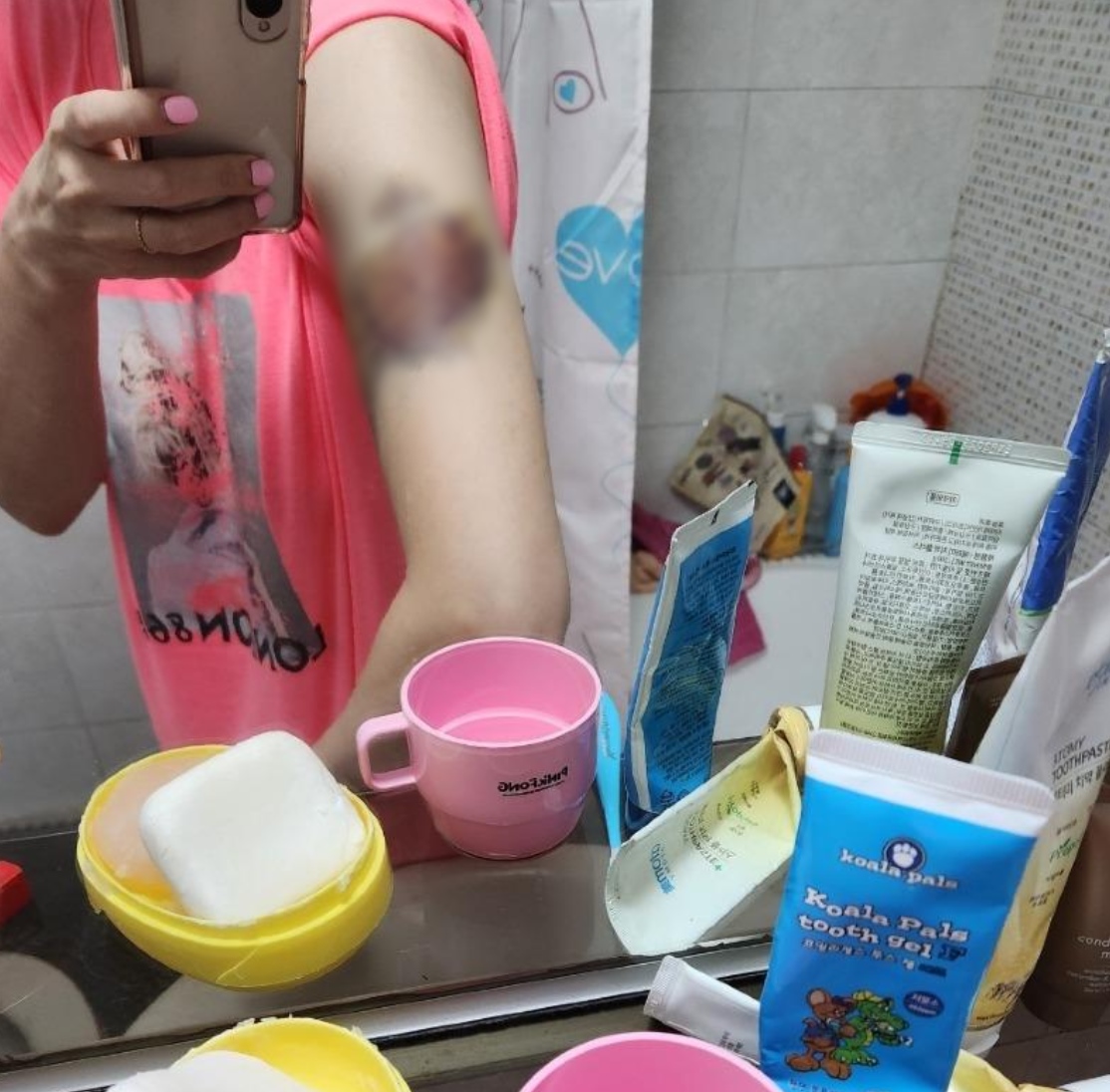 이은총 씨 스토킹 폭행 사진