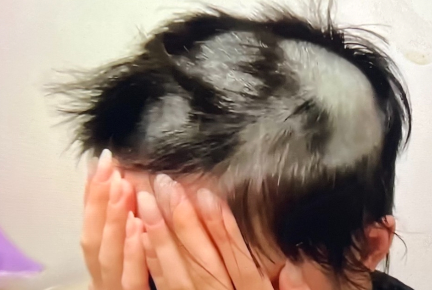 바리깡 폭행 사건 피해자