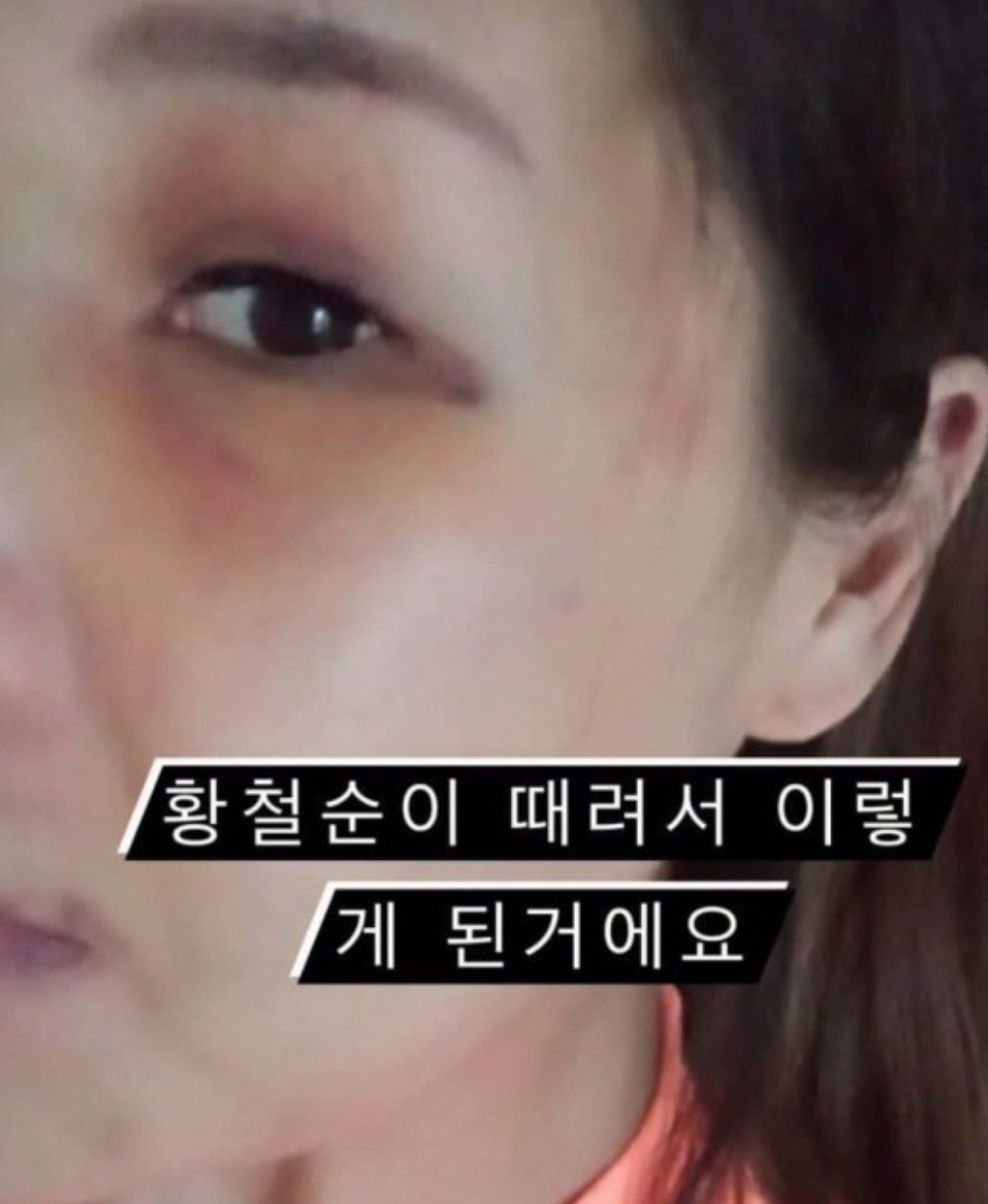황철순 지연아 폭행 인스타 사진