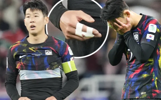 손흥민 손가락 탈구 부상