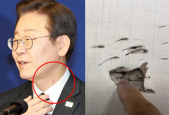 이재명 목 흉터와 김진성 연습 흔적